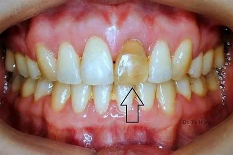 竹鼠牙齿变黑色啥原因？